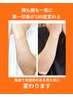 【早い者勝ち！７名様限定♪】腕全体脱毛２回＋顔脱毛２回　28600円→14400円
