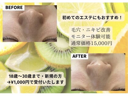 ミルトゥ(myrte)の写真
