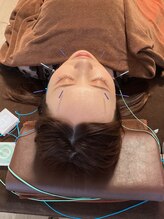 ハリファ鍼灸院 横浜関内院(HariFa鍼灸院)/美容施術・美容鍼