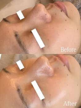 イルー(ILuu)/お客様ビフォーアフター