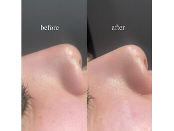 ヨキ(jogi)/【つるつる肌】フェイスワックス