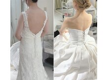 美容整骨小顔ラボ/ブライダル　ビフォーアフター