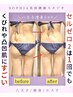 【痩身】最新たっぷり痩身/コリむくみ撃退セルライトゼロ2＆マッサージ120分 