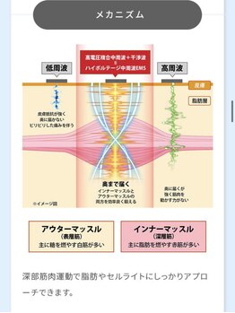 ベルシア(BELXIA)/業界初の機械×ハンドの痩身