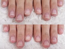 グレースレディ/数々の症例多数掲載