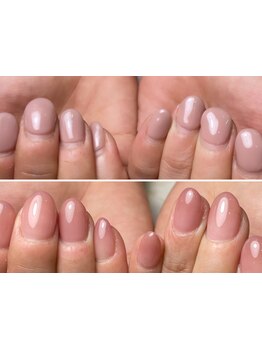 爪の悩みを解消できる（ケア含む）