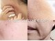 サロン ド ボーテ シャルル(Chaleureux)の写真