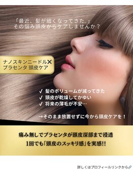 ミルトゥ(myrte)/1回でも頭皮のスッキリ感を実感