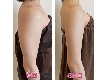 オードリリー(eau de Lily)/コンプレックス解消！