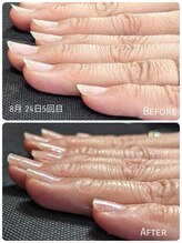 リエル(RIELE)/反り爪の悩みも解決