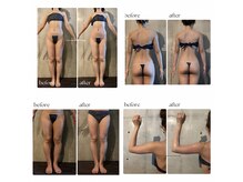 ボーレーヴ 表参道店(beaureve)/施術効果写真（before after）