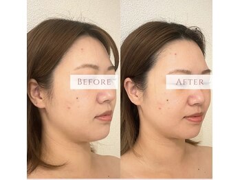 ソナ 大和西大寺院(SONA)/