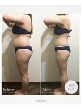 エスプライザ 横浜駅前店/半年のケアで理想のお姿に！