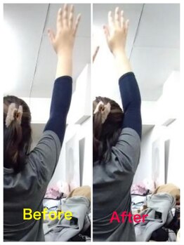 やさしい手/before after