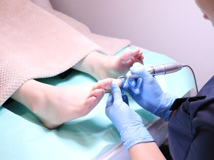 巻き爪補正店 大分店の写真