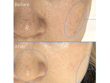 ビューティーツリー(Beauty Tree)の雰囲気（シミさよなら！）