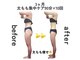 ジュリアン 千葉店(Julien)の写真/短期集中でサイズダウンを目指したい方に◎結果重視のオーダーメイド施術!