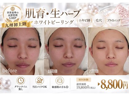 クリニカルエステ/イーズ パークプレイス大分店の写真