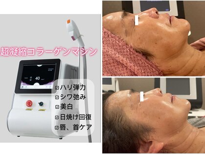 エミュ(e'mu)の写真