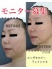【モニター募集】3か月で変化させるあなたの理想のお顔