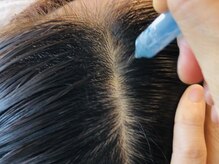 スーパースカルプ 大橋駅前店(Super Scalp)/以上