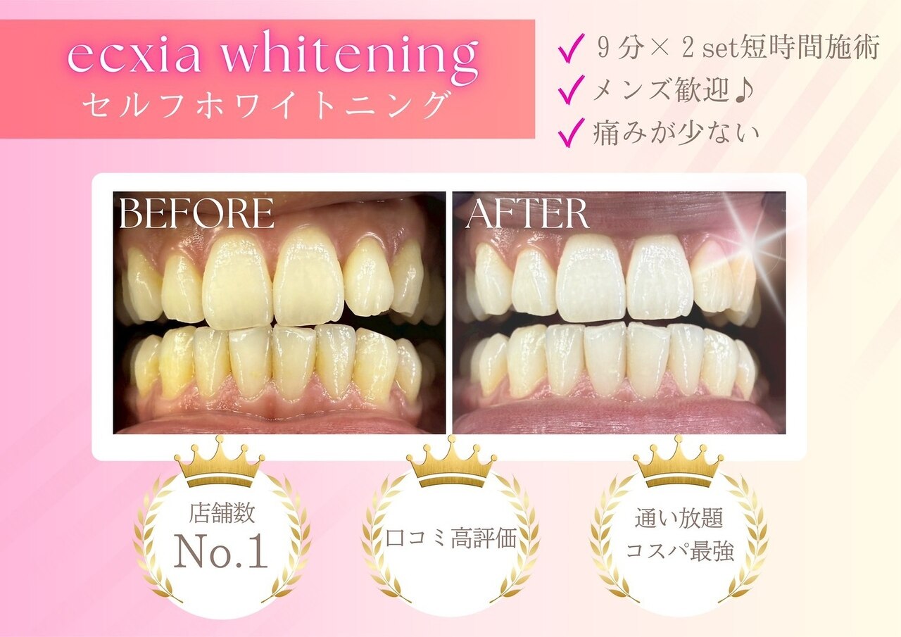 エクシア ホワイトニング 鶴岡店｜ホットペッパービューティー