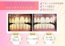 エクシア ホワイトニング 鶴岡店