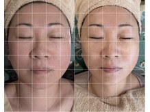 ココロ(COCORO)/【超小顔術】韓国式バンテージ