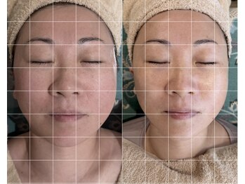 ココロ(COCORO)/【超小顔術】韓国式バンテージ