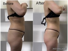 ラヴィアンローズ 津島店(La vie en Rose)/◇ビフォーアフター◇