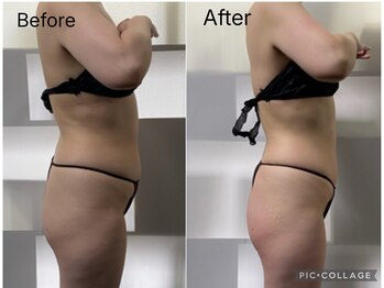 ラヴィアンローズ 津島店(La vie en Rose)/◇ビフォーアフター◇