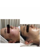 ビズビズ(bisebise)/