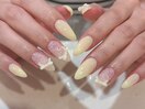 ちゅるんイエロー/レース