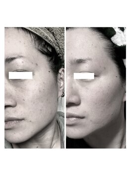 ヒルナム(Heal Nam)/プロセルセラピーズ~フェイス~