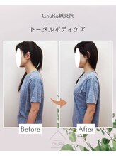 チュラ鍼灸院 西宮北口(ChuRa鍼灸院)/姿勢改善【整体】