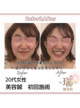 瑞 鍼灸院/ビフォーアフター