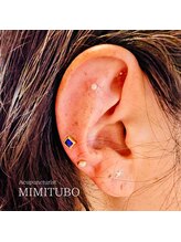 加島鍼灸接骨院/耳つぼジュエリー