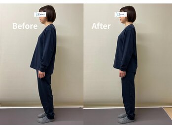 イース整体院(Ease整体院)/反り腰や猫背姿勢には骨格矯正◎