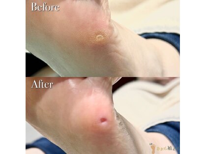 巻き爪補正店 大分店の写真