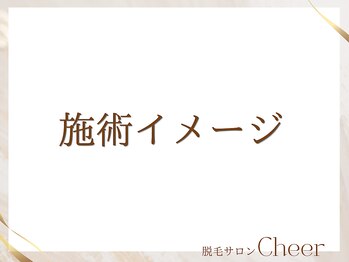 チア(Cheer)/施術イメージ