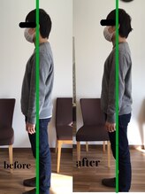 ハーベスト治療院/姿勢矯正