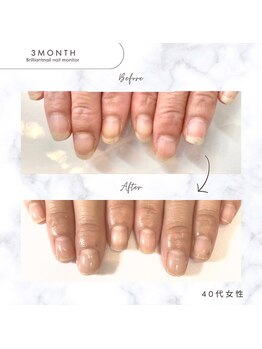 インプルーヴ(improve)/