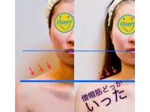 シュガーリングハウスレディ(SugaringHouse LADY)/かっさ『番外編』