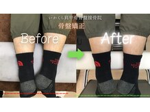 いわくら肩甲骨 骨盤接骨院BTG 一宮千秋/骨盤矯正・姿勢矯正　#整体