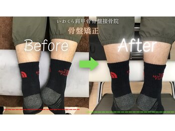 いわくら肩甲骨 骨盤接骨院BTG 一宮千秋/骨盤矯正・姿勢矯正 #整体