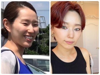 シェノン(Chainon)/エステでこんなに変わった!