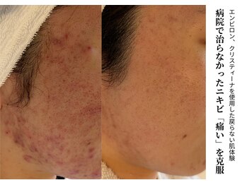 ハナコ 健軍店(HANAKO)