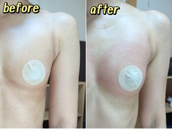 スノードロップ(snowdrop)/