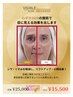 【特別38%OFF】ギノーVAR [たるみ・シワ・ほうれい線・リフトアップ]¥25000→