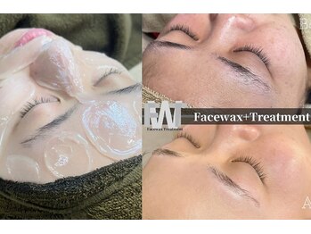 ソイビューティー(Soi beauty)の写真/産毛、毛穴汚れを一掃♪うる艶Waxでつるんとたまご肌へ◎